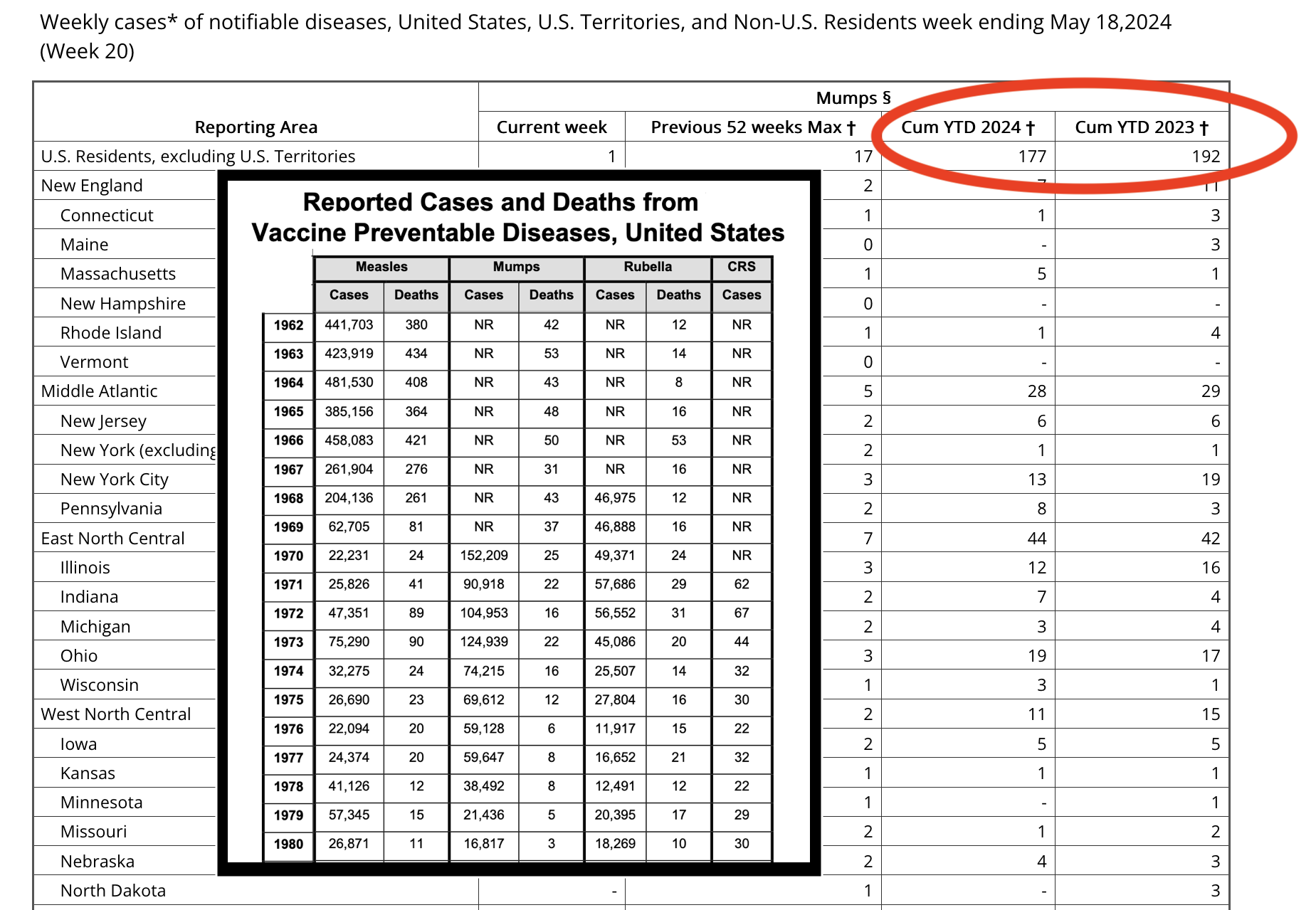 Andy Wakefield likely doesn't mention that 2,379 lives have been saved by the mumps vaccine in the US alone.